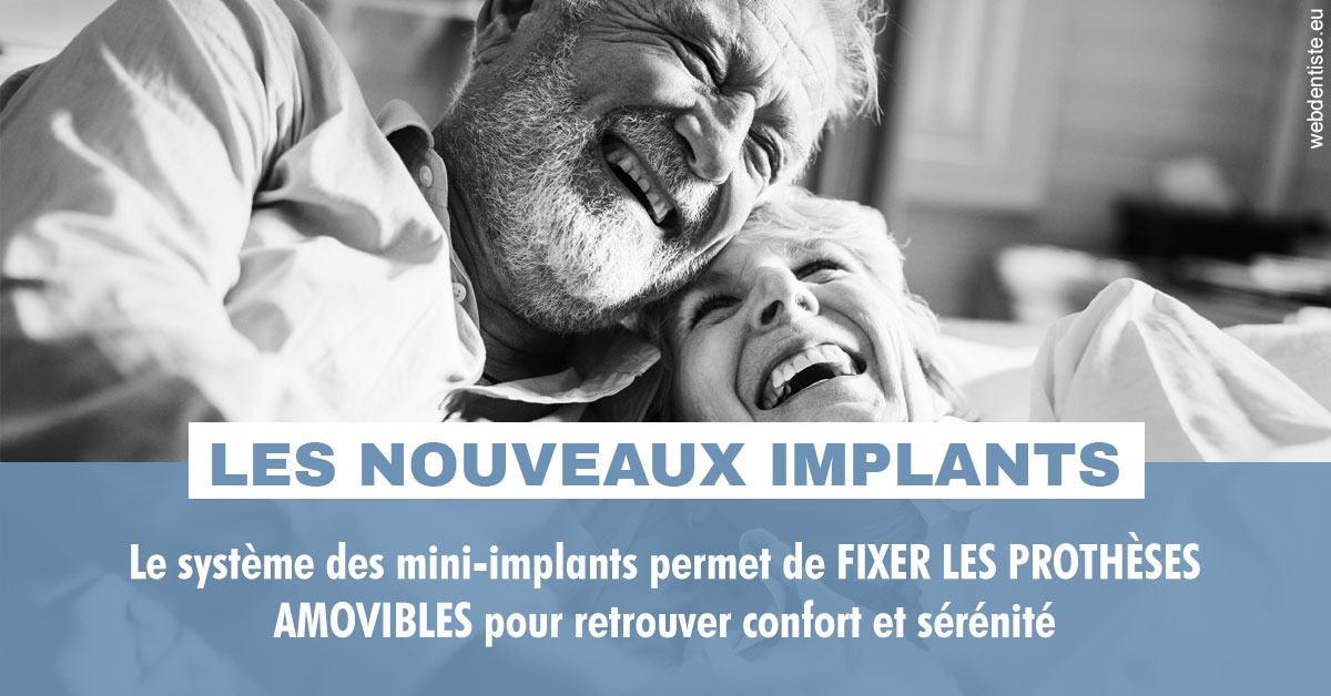 https://dr-rouhier-francois.chirurgiens-dentistes.fr/Les nouveaux implants 2