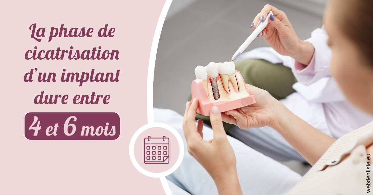 https://dr-rouhier-francois.chirurgiens-dentistes.fr/Cicatrisation implant 2