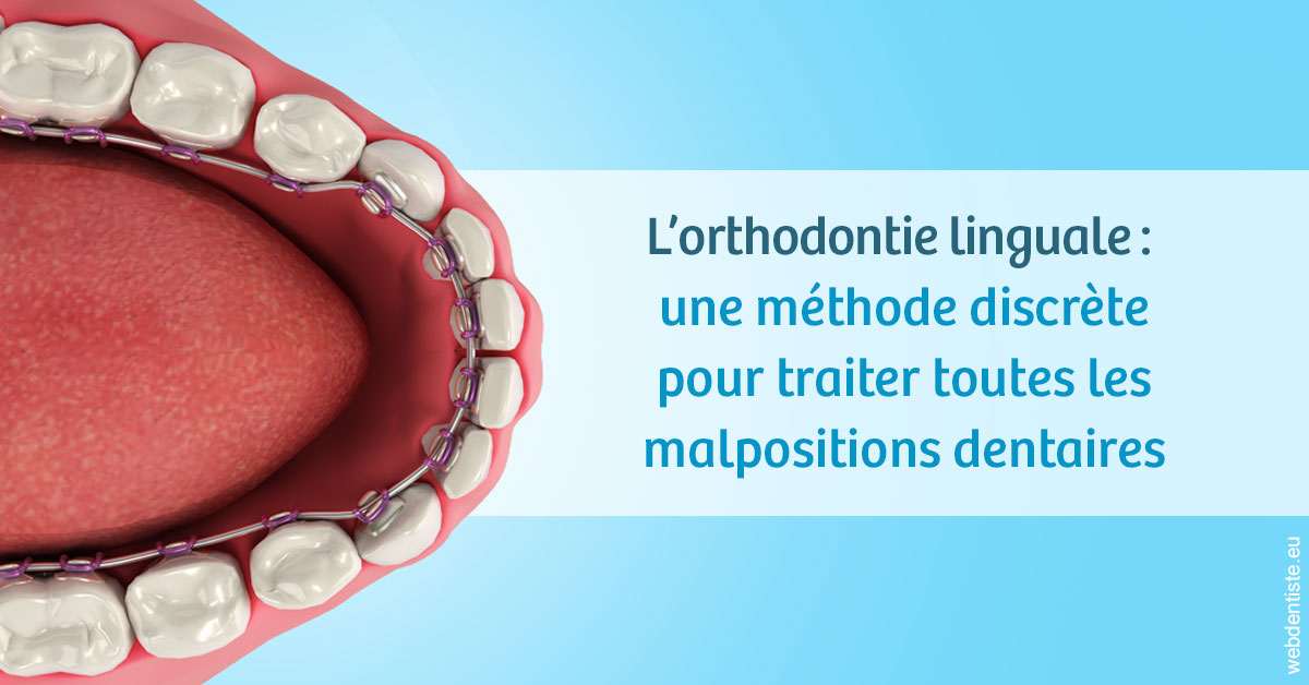 https://dr-rouhier-francois.chirurgiens-dentistes.fr/L'orthodontie linguale 1