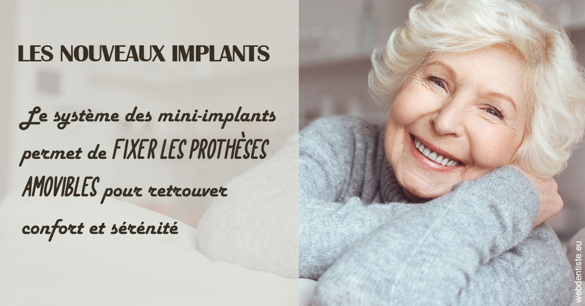 https://dr-rouhier-francois.chirurgiens-dentistes.fr/Les nouveaux implants 1