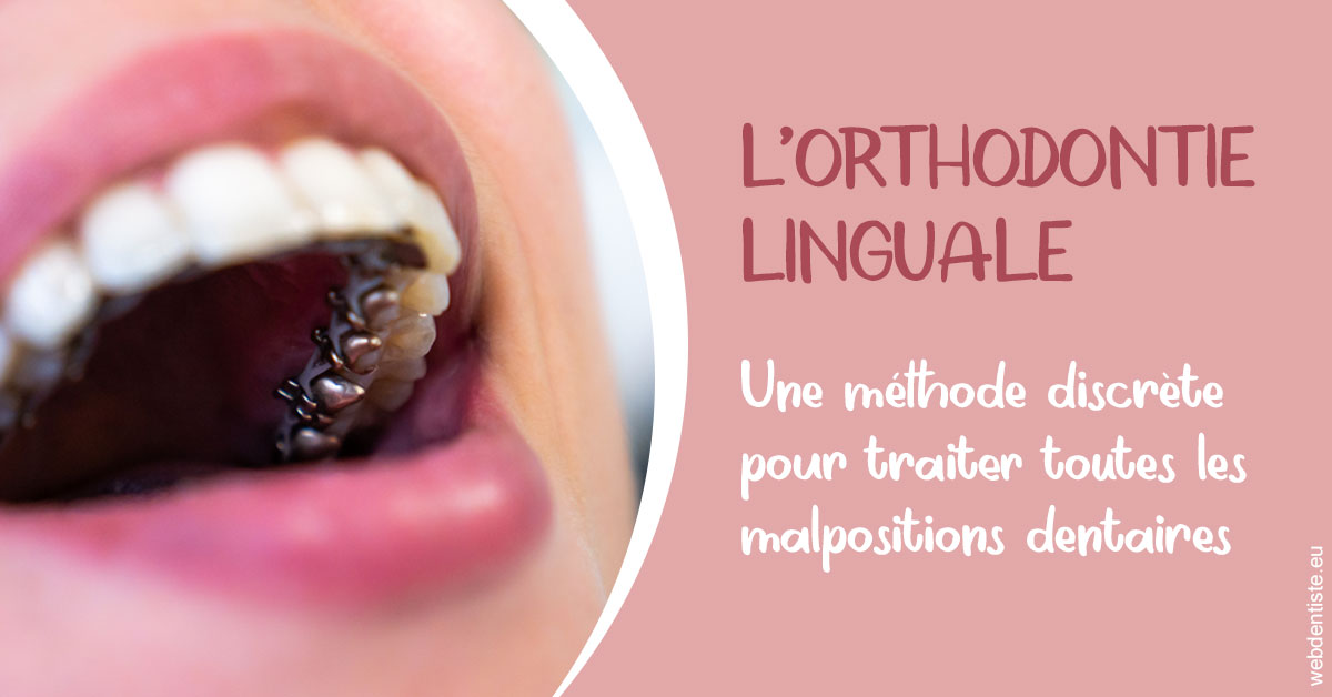 https://dr-rouhier-francois.chirurgiens-dentistes.fr/L'orthodontie linguale 2