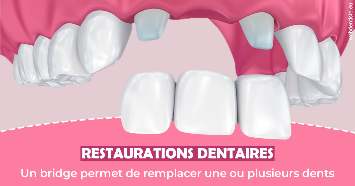https://dr-rouhier-francois.chirurgiens-dentistes.fr/Bridge remplacer dents 2