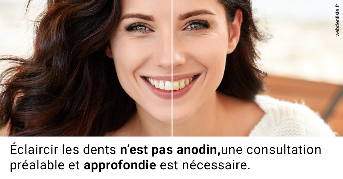 https://dr-rouhier-francois.chirurgiens-dentistes.fr/Le blanchiment 2