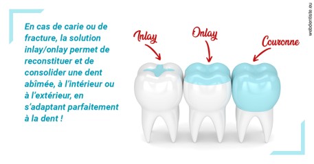 https://dr-rouhier-francois.chirurgiens-dentistes.fr/L'INLAY ou l'ONLAY