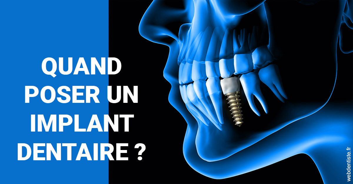 https://dr-rouhier-francois.chirurgiens-dentistes.fr/Les implants 1