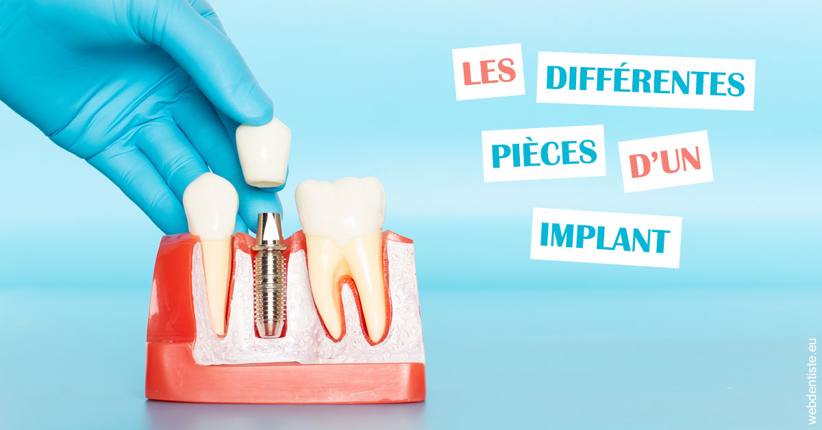 https://dr-rouhier-francois.chirurgiens-dentistes.fr/Les différentes pièces d’un implant 2