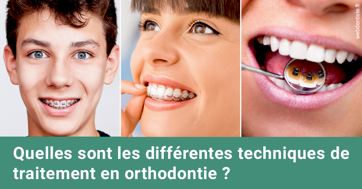 https://dr-rouhier-francois.chirurgiens-dentistes.fr/Les différentes techniques de traitement 2