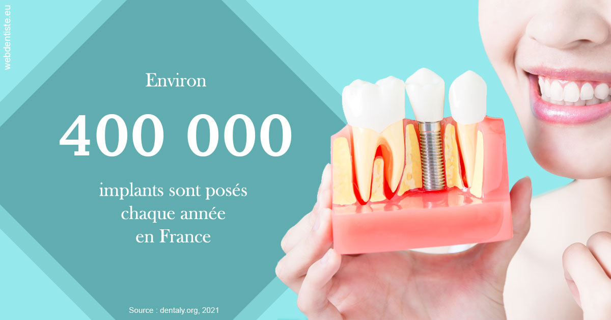 https://dr-rouhier-francois.chirurgiens-dentistes.fr/Pose d'implants en France 2