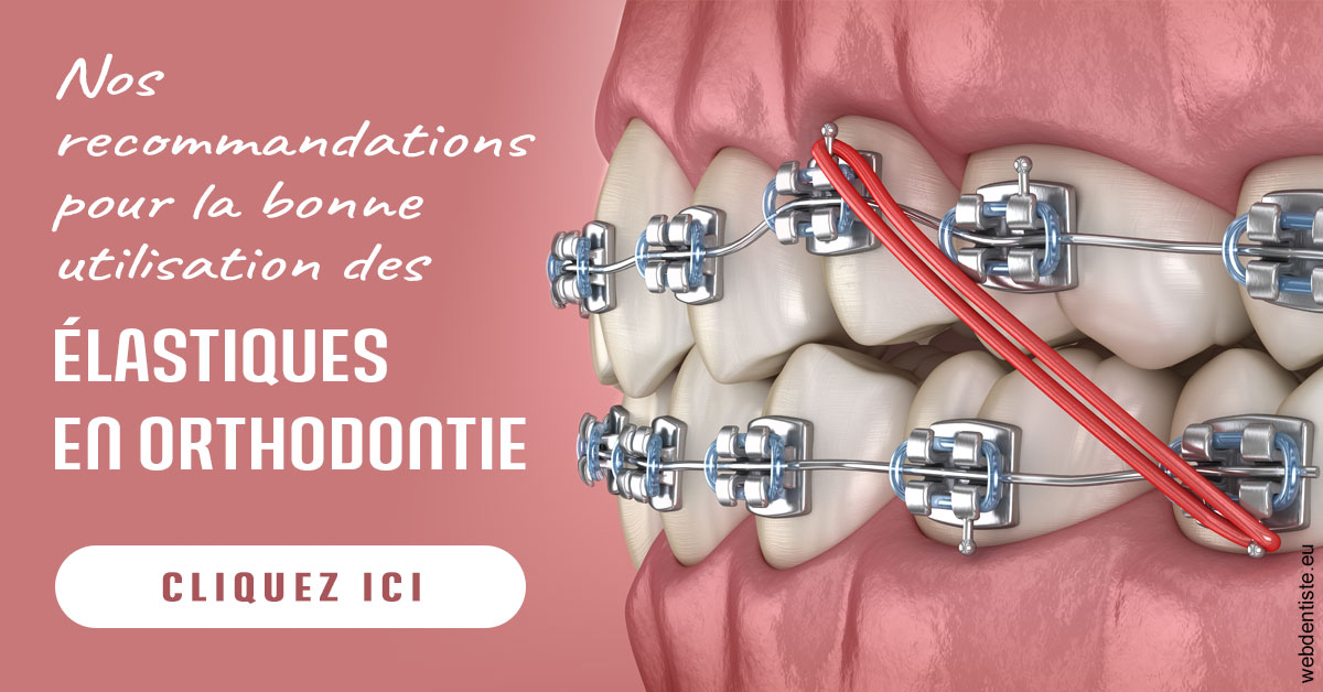 https://dr-rouhier-francois.chirurgiens-dentistes.fr/Elastiques orthodontie 2